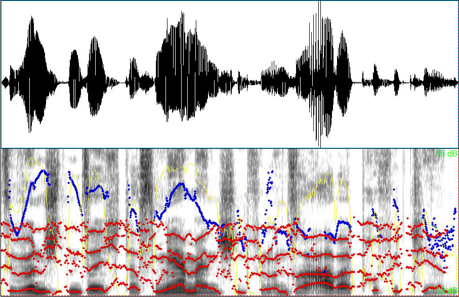 Acoustic Voice Profiling Curves