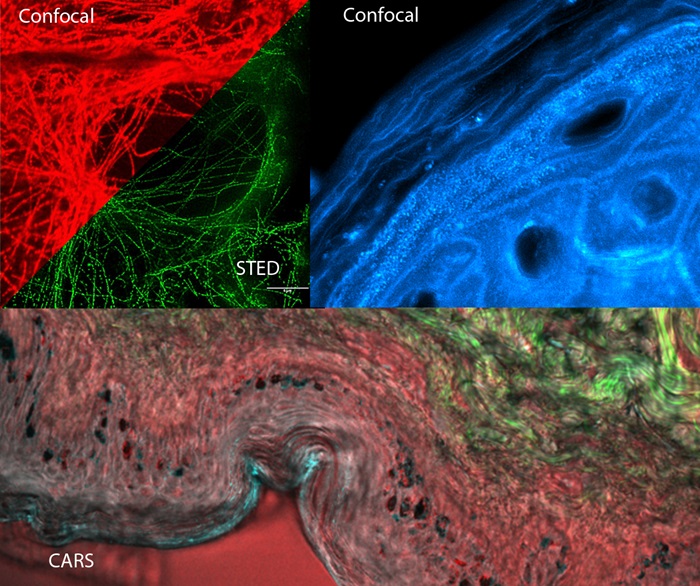 CARS microscopy on skin
