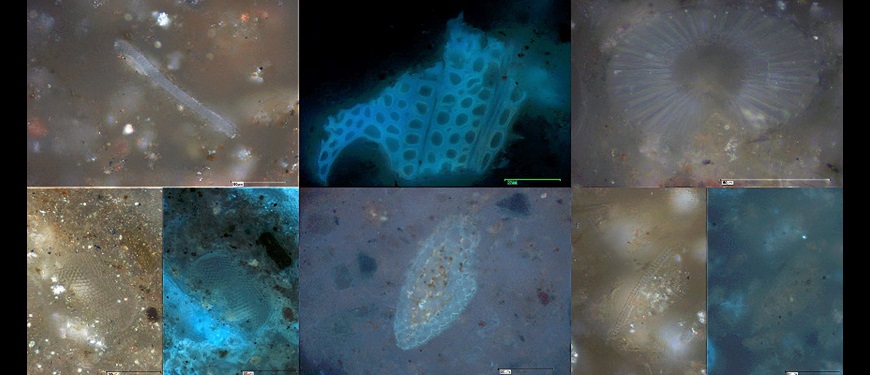 Microscope images of hadal sediment
