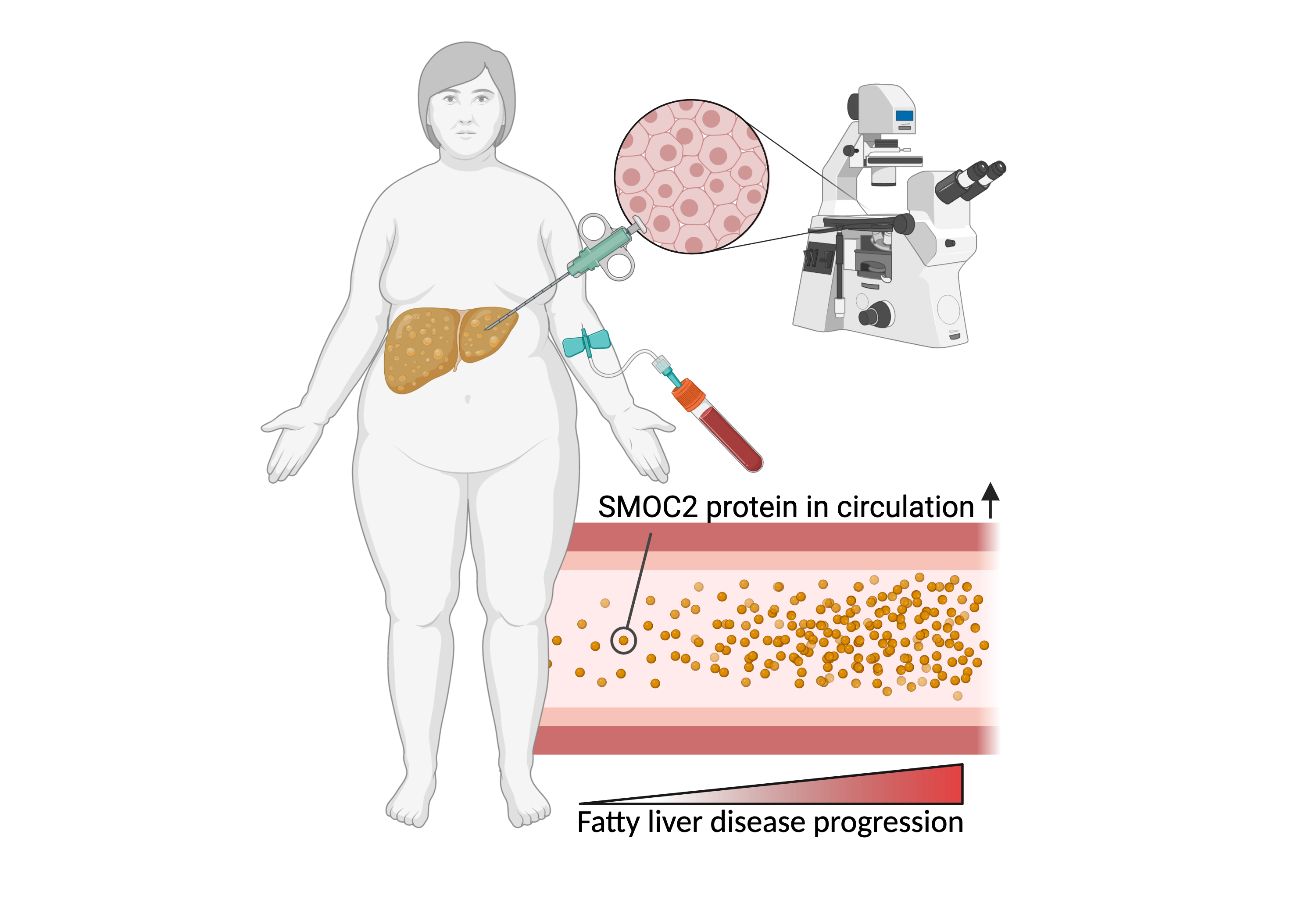 The protein SMOC2 as a blood-based biomarker for non-alcoholic fatty liver disease