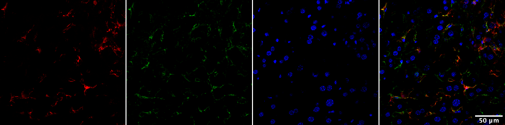 Immunofluorescent labeling of healthy murine liver for a HSCs specific GsPCR (Red), HSCs (green), and nuclei (DAPI) at 40x.
