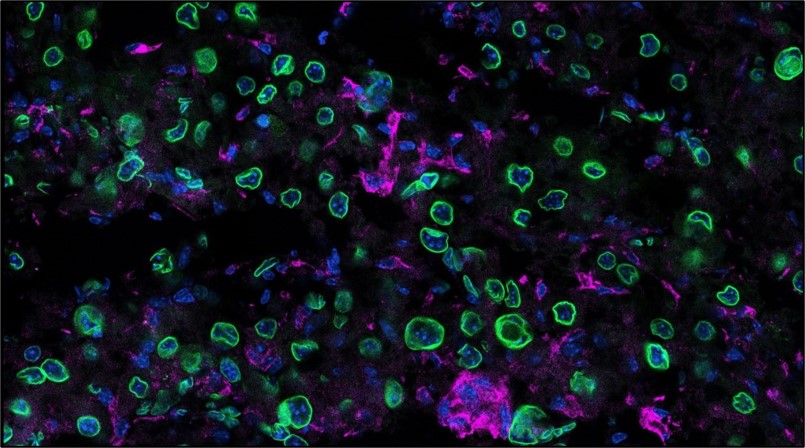 Immunoflourescent photo of liver from Western diet mice