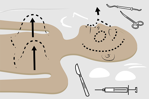 Grafisk illustration af person inden plastikoperation