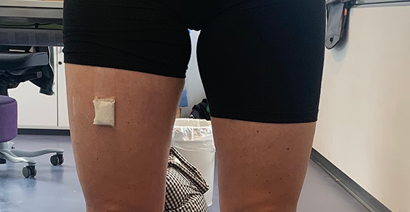 Bevægelsesmåler på låret. 