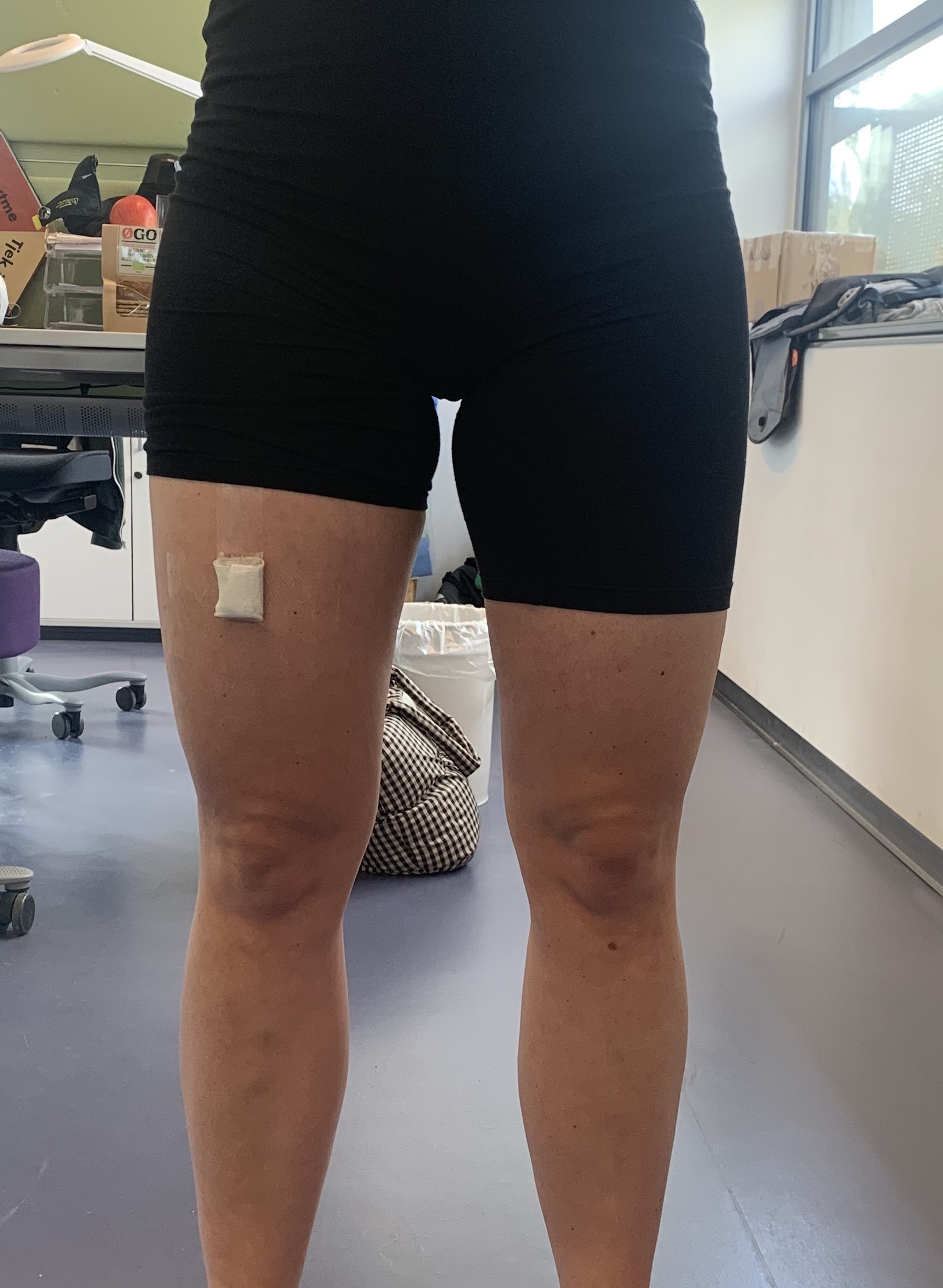 placering af aktivitetsmåler