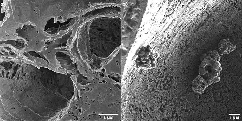 Mouse kidney