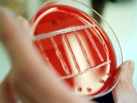 Hand holding a petri dish with red agar and streaked bacterial culture.