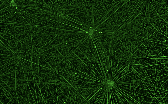 De smertefølende nerveceller er forbundet med et komplekst netværk, der er vist med den grønne farve. Billedet viser raske smertefølende nerveceller, der ikke er blevet behandlet med det kemoterapeutiske lægemiddel paclitaxel