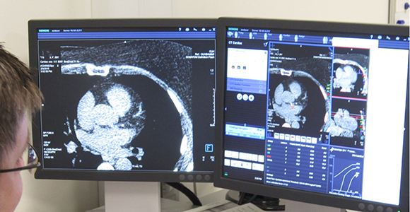 Læge analyserer CT-scanning af hjerte på to computerskærme i medicinsk diagnosemiljø.