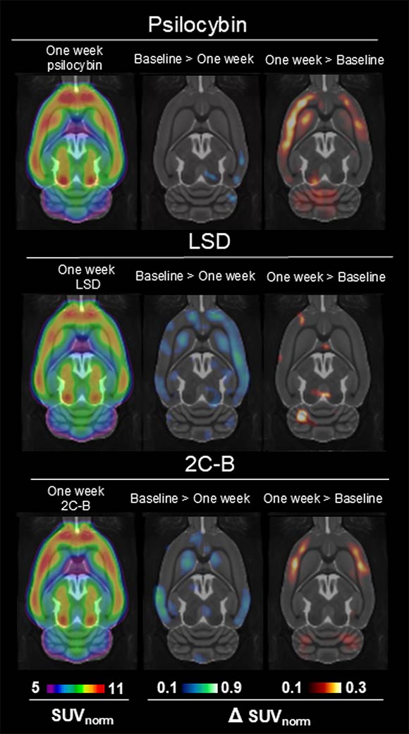 Hjernescanninger én uge efter indtagelse af psilocybin, LSD og 2C-B, med farvekodede sammenligninger af SUV-værdier og ændringer fra baseline.