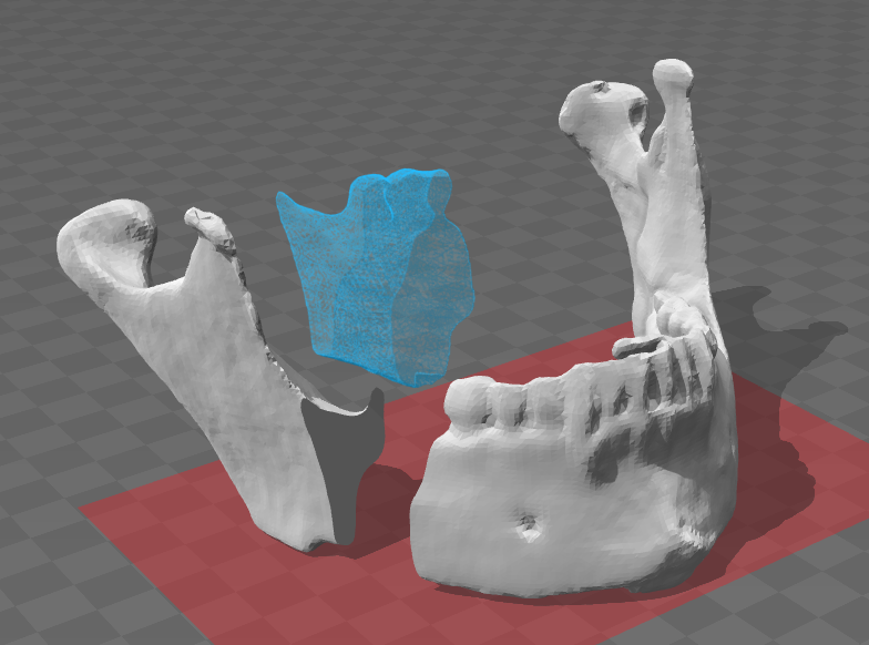 3D-visning af hvide kæbefragmenter med et blåmarkeret segment på et gråt ternet underlag.