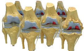 Knee