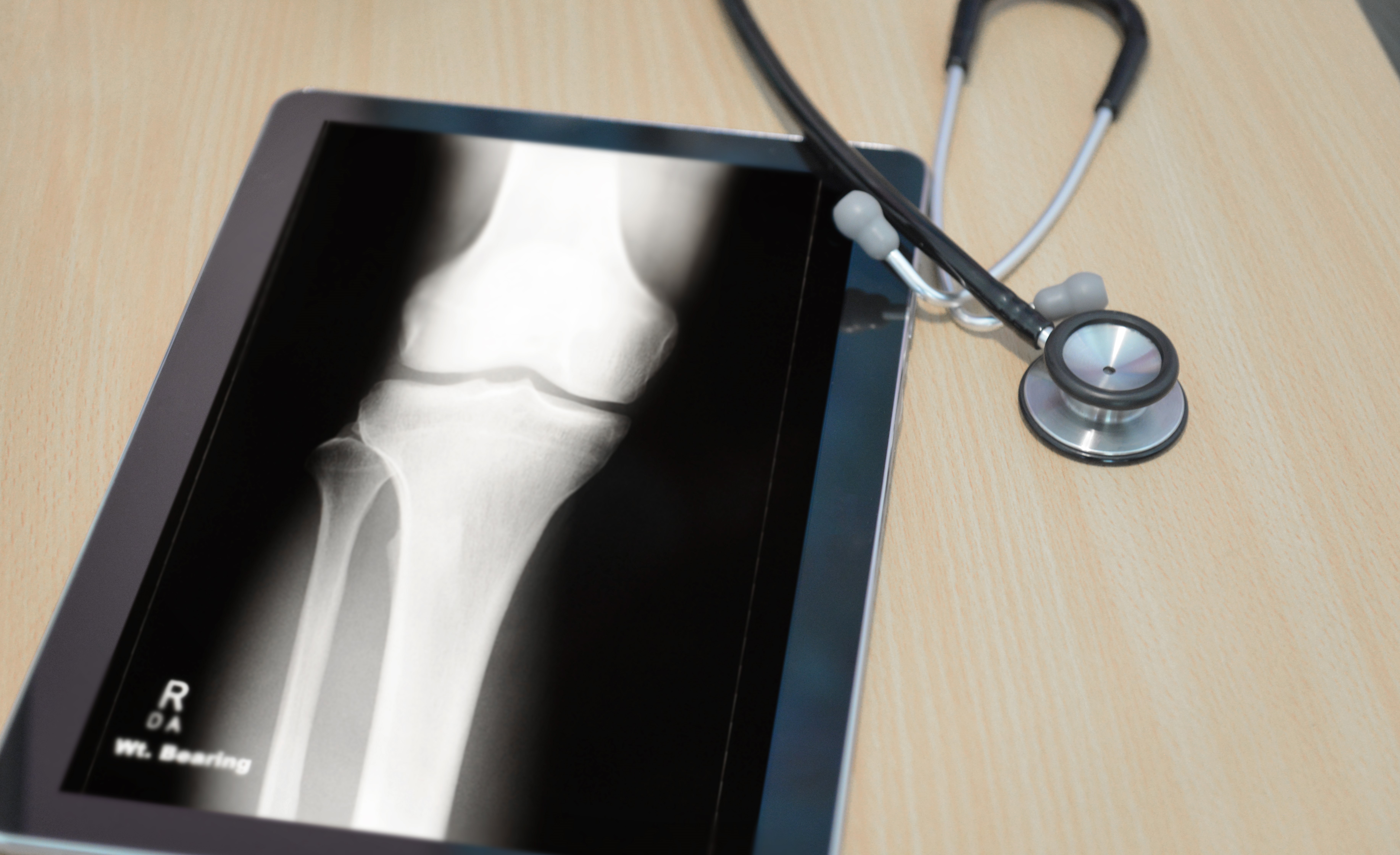 Tablet med røntgenbillede af et kne