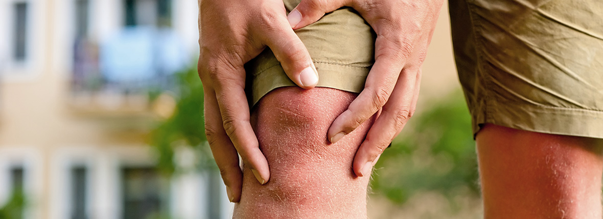 Leddegigt blandt danske tvillinger Leddegigt hos danske tvillinger