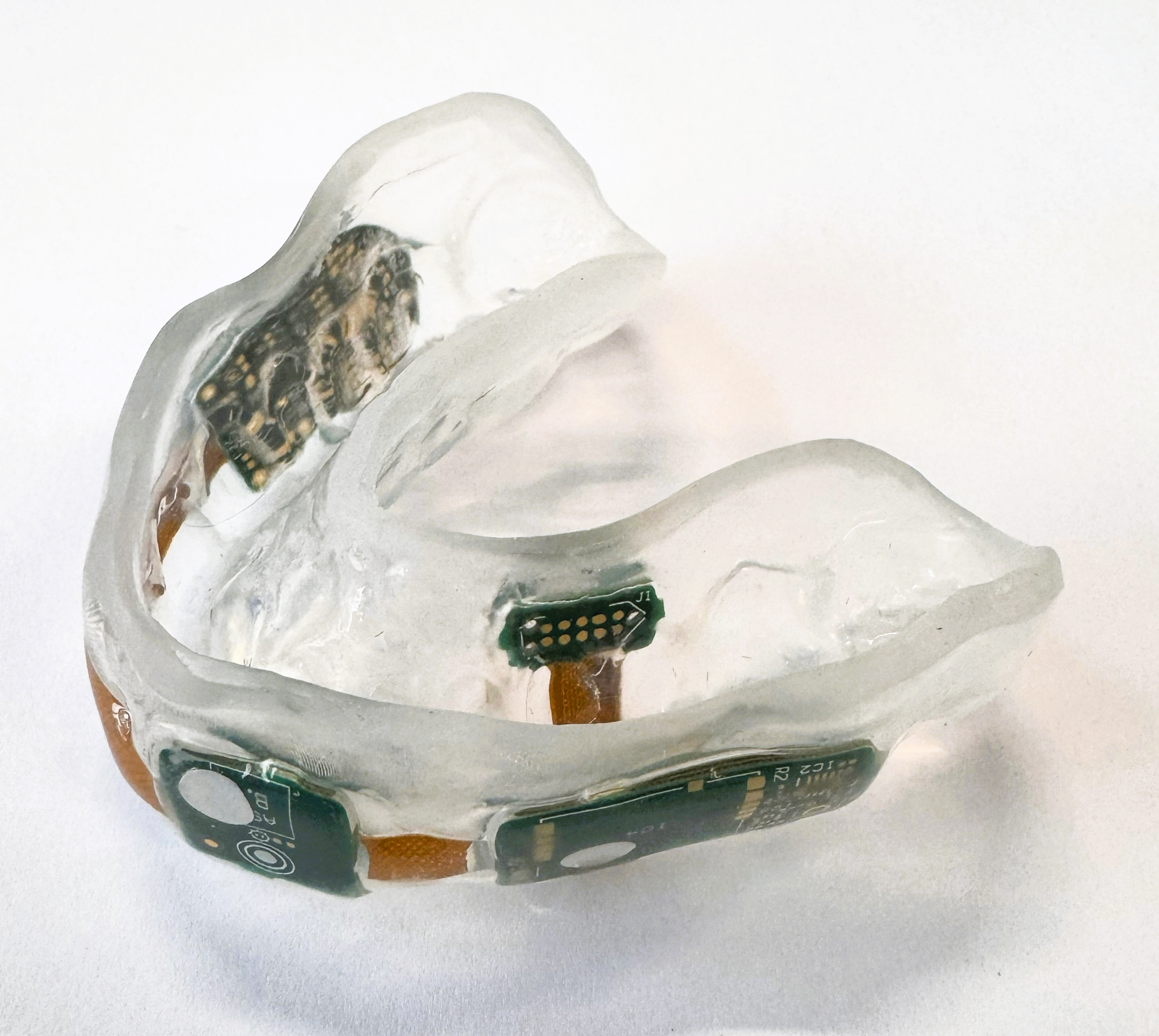 Mouthguard