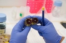 Indstøbte histologiske præparater