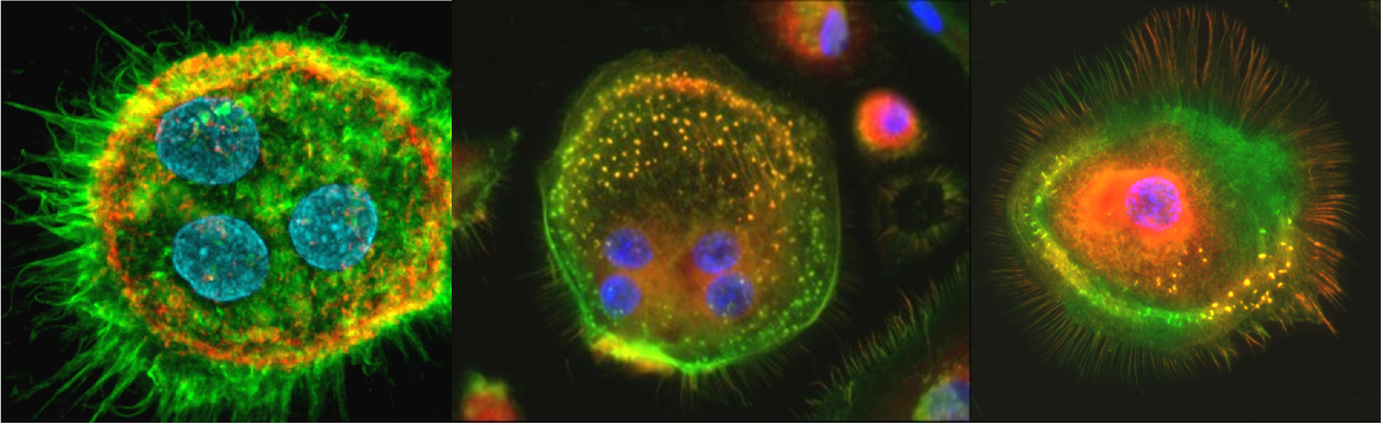 Confocal Microscopy