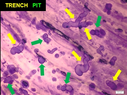 Trench and Pit