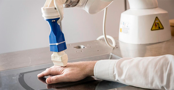 ROPCA ultrasound robot