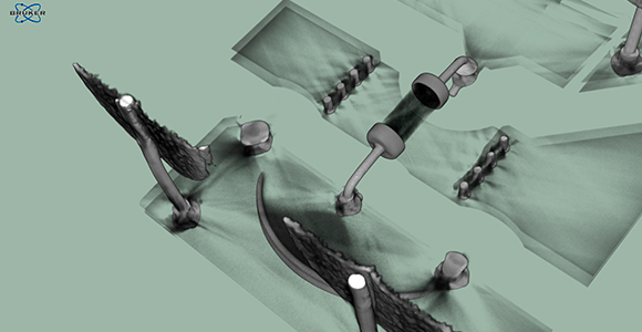 X-ray image of a capacitor with defect contact