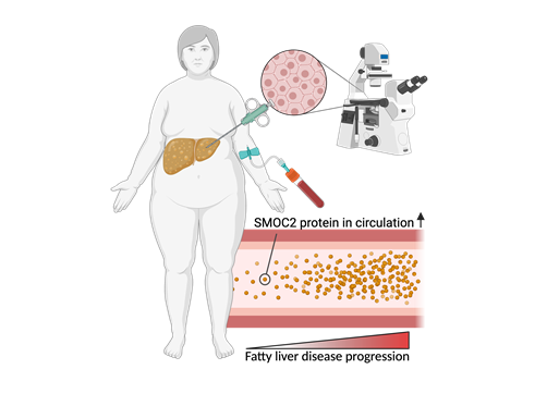 SMOC2 is a novel biomarker found at elevated levels in NASH patients